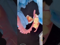 3D Print Model Estetika Tinggi Gigi TCS Valplast Fleksibel Bagian Gigi Gigi Lab Gigi